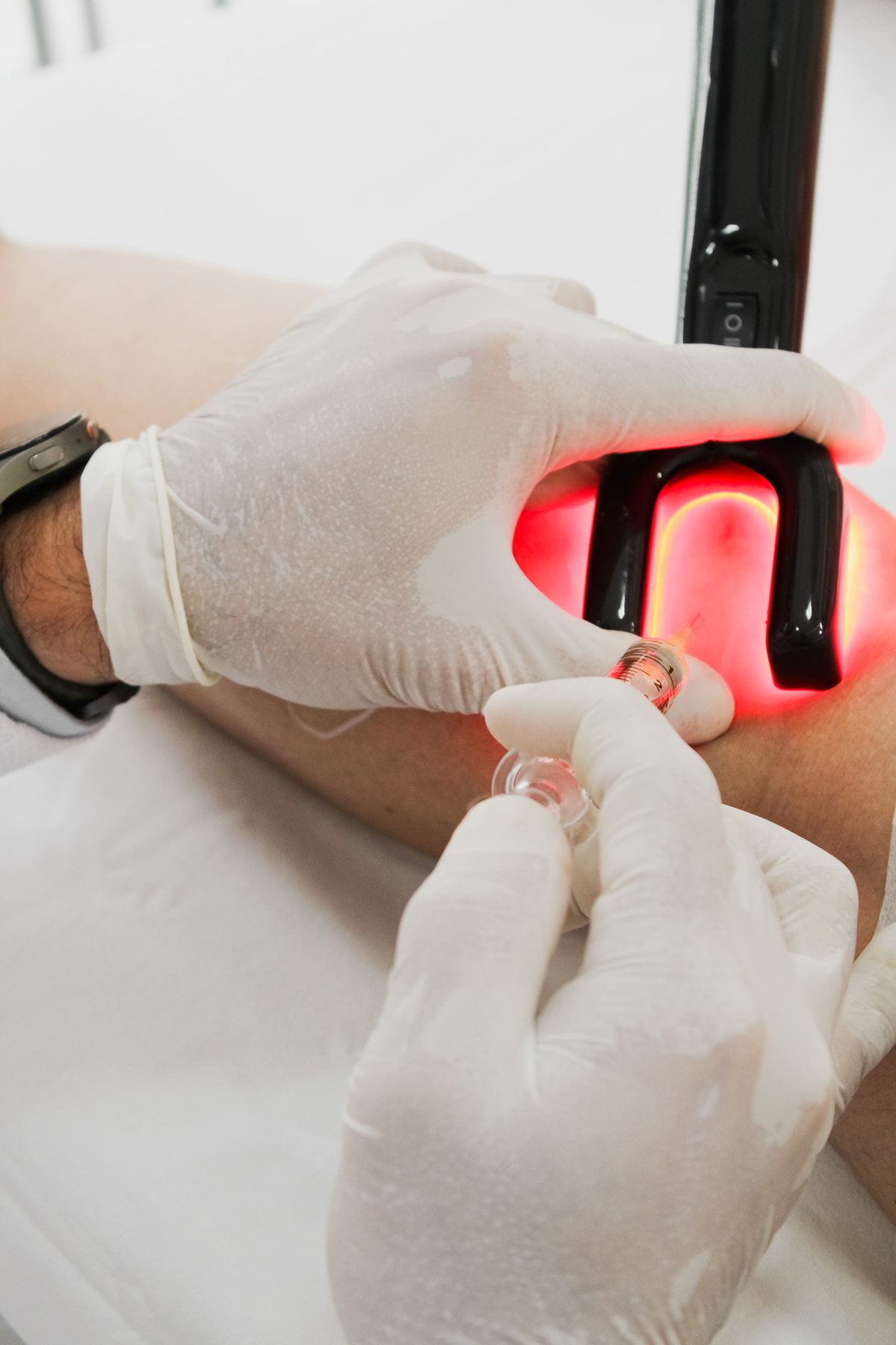 Técnica CLaCS – laser e microaplicação simultâneos
